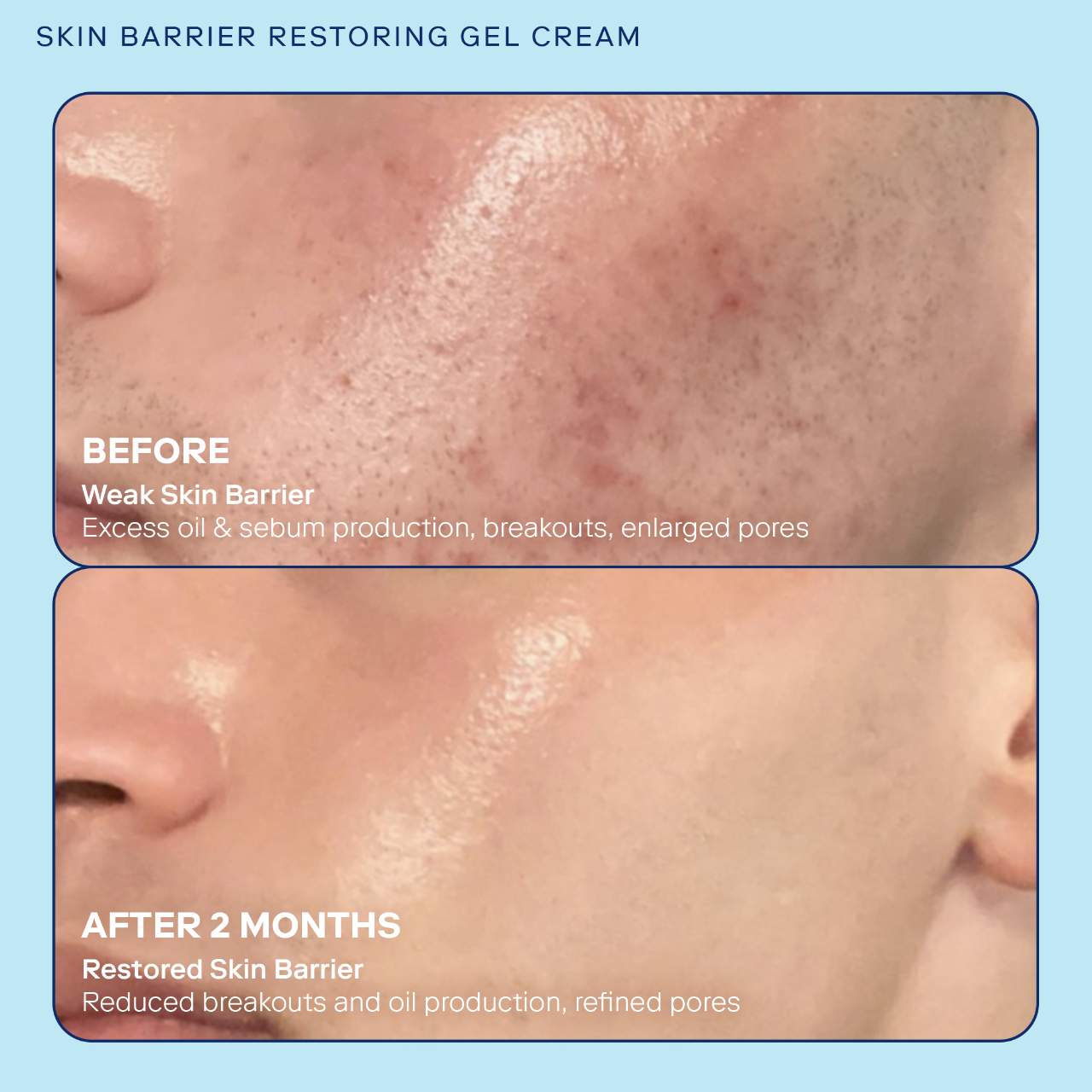 Skin Barrier+ Pore Refining Refillable Gel Cream with Niacinamide 