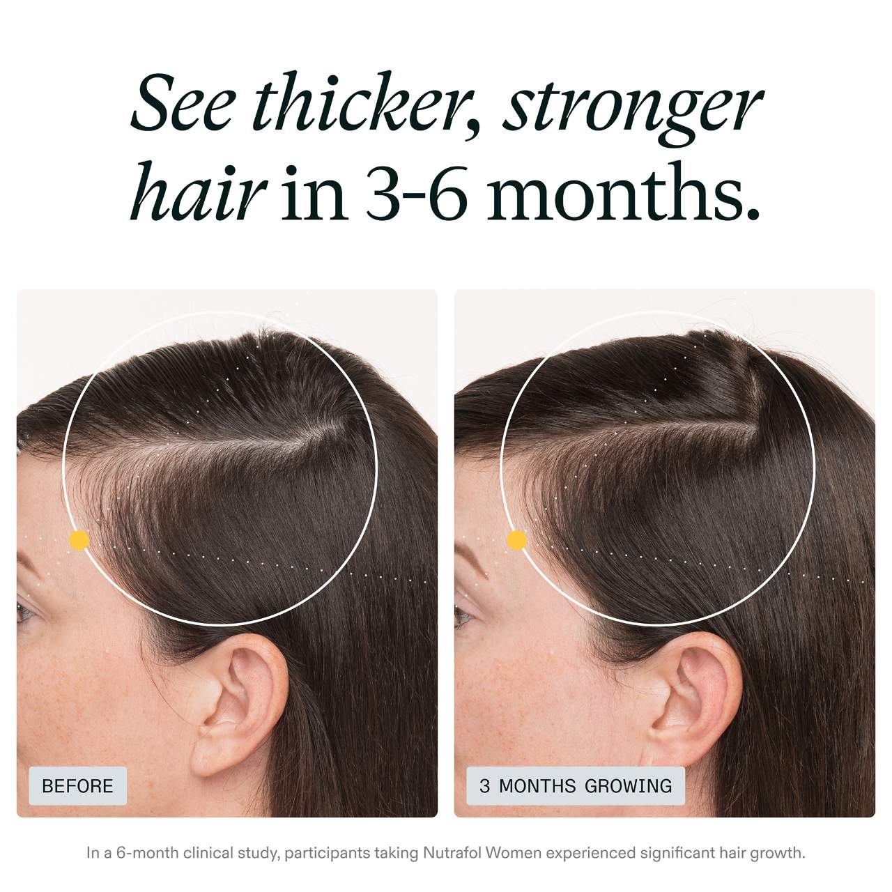 WOMEN Clinically Proven Hair Growth Supplement for Thinning