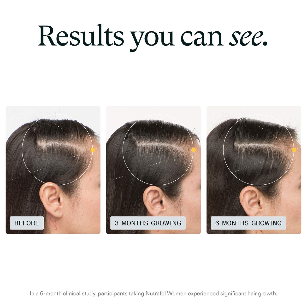 WOMEN Clinically Proven Hair Growth Supplement for Thinning