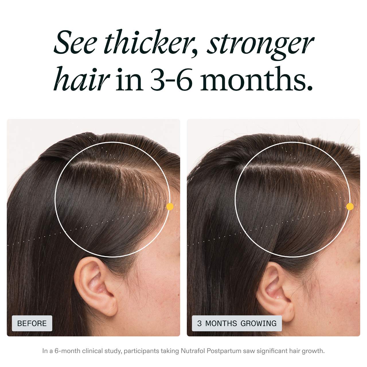 POSTPARTUM OBGYN-Formulated Hair Growth Supplement for Thinning & Full-Body Recovery Support