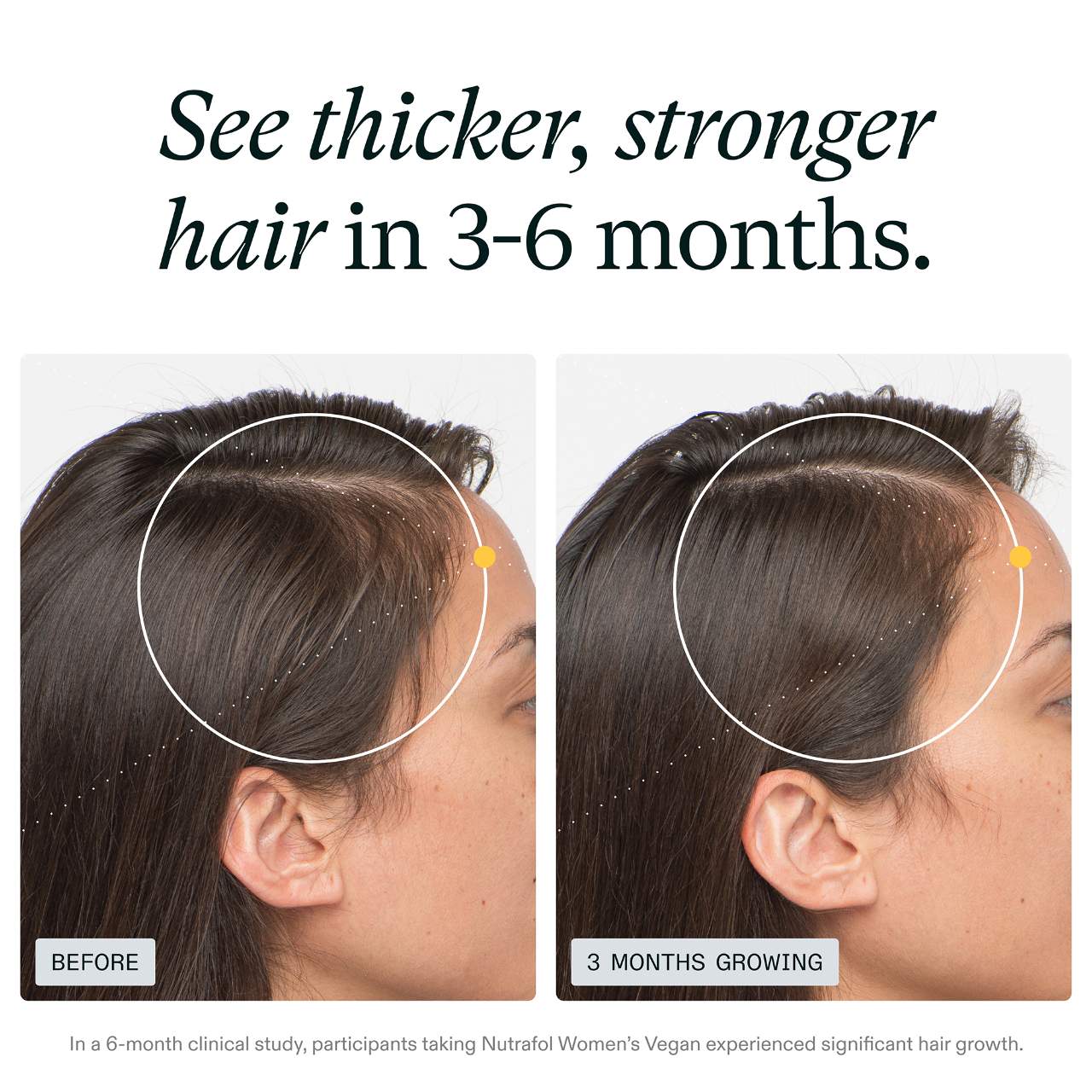 WOMEN’S VEGAN Clinically Proven Hair Growth Supplement for Thinning