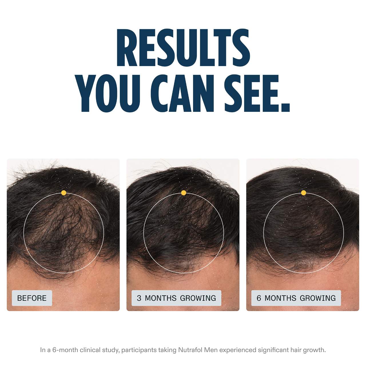 MEN Clinically Proven Hair Growth Supplement for Thinning