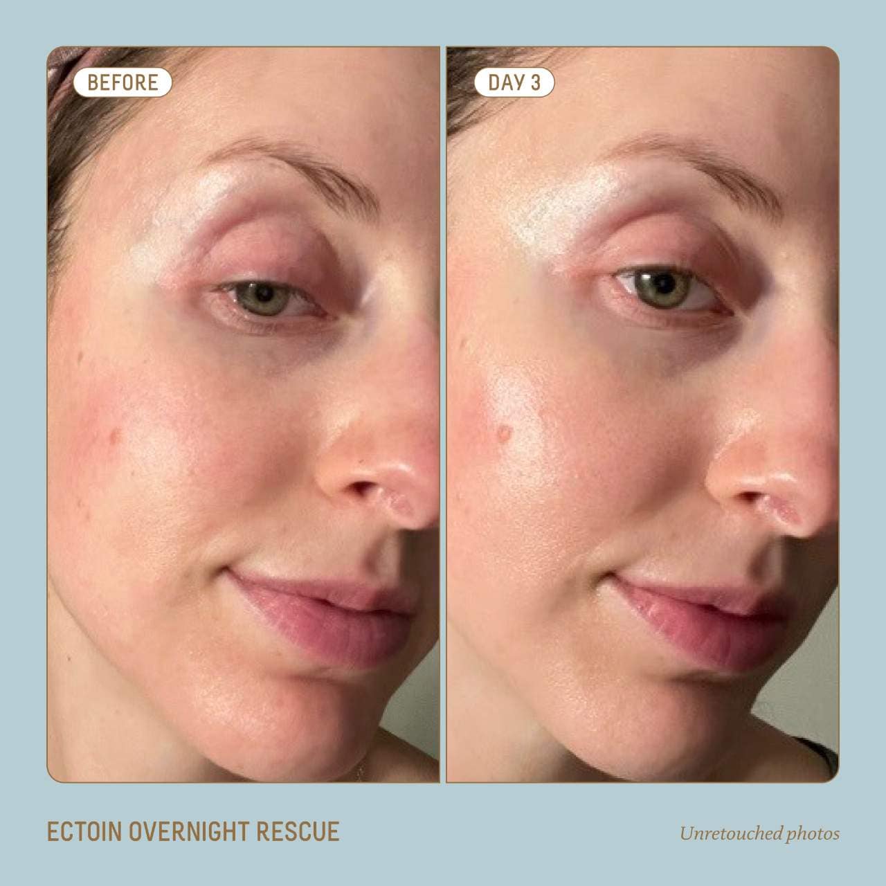 Squalane + Ectoin Overnight Rescue Deep Repair Night Moisturizer