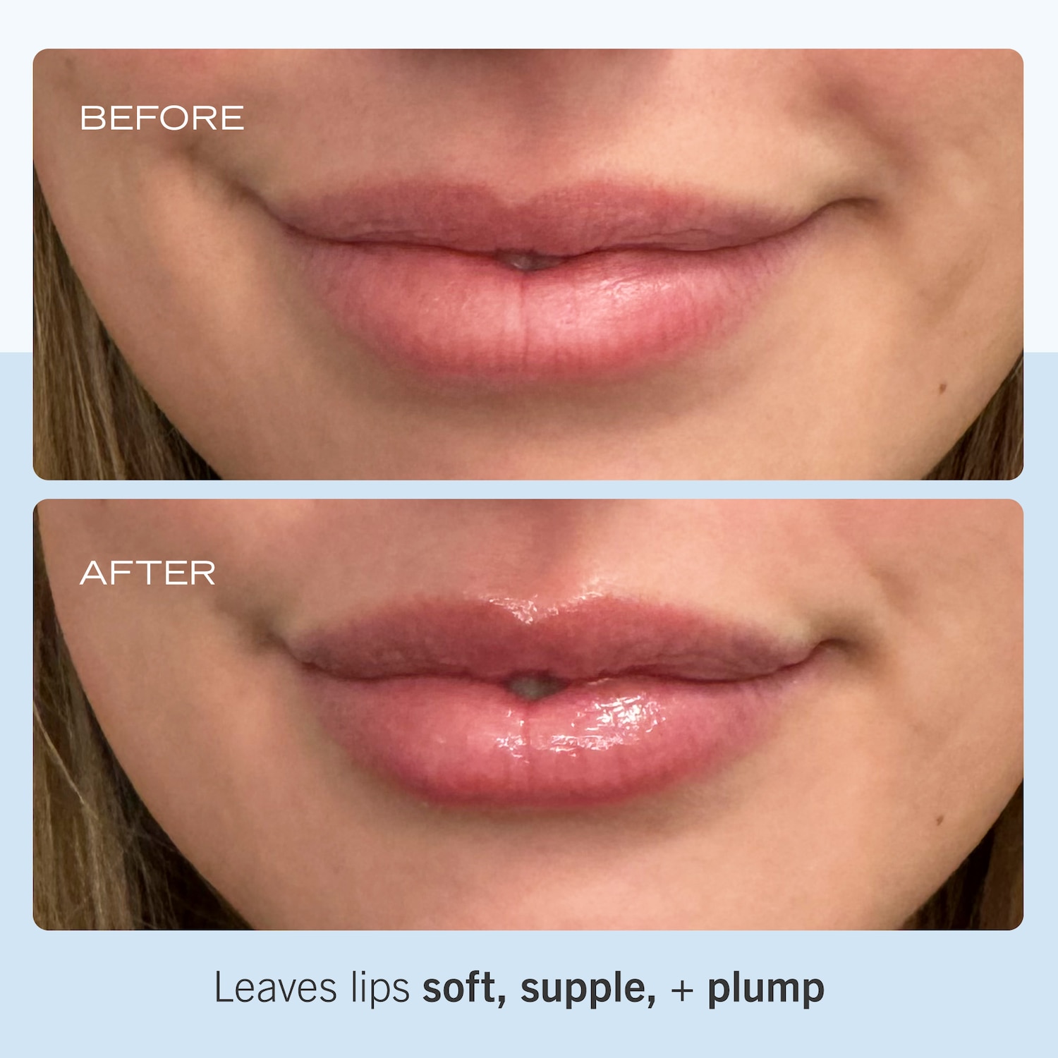 Ultra Repair Lip Balm