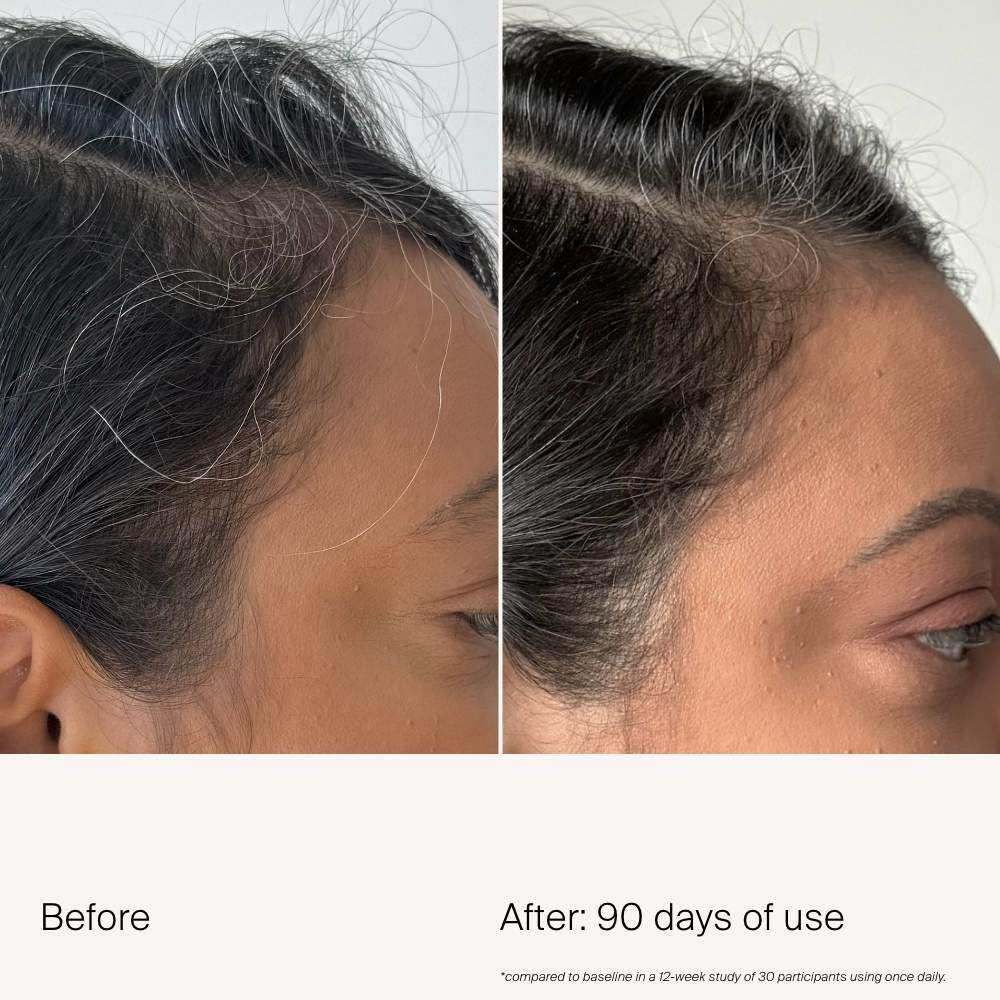 Scalp Care Density Serum for Thinning & Greying Hair