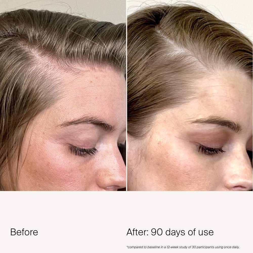 Scalp Care Density Serum for Thinning & Greying Hair