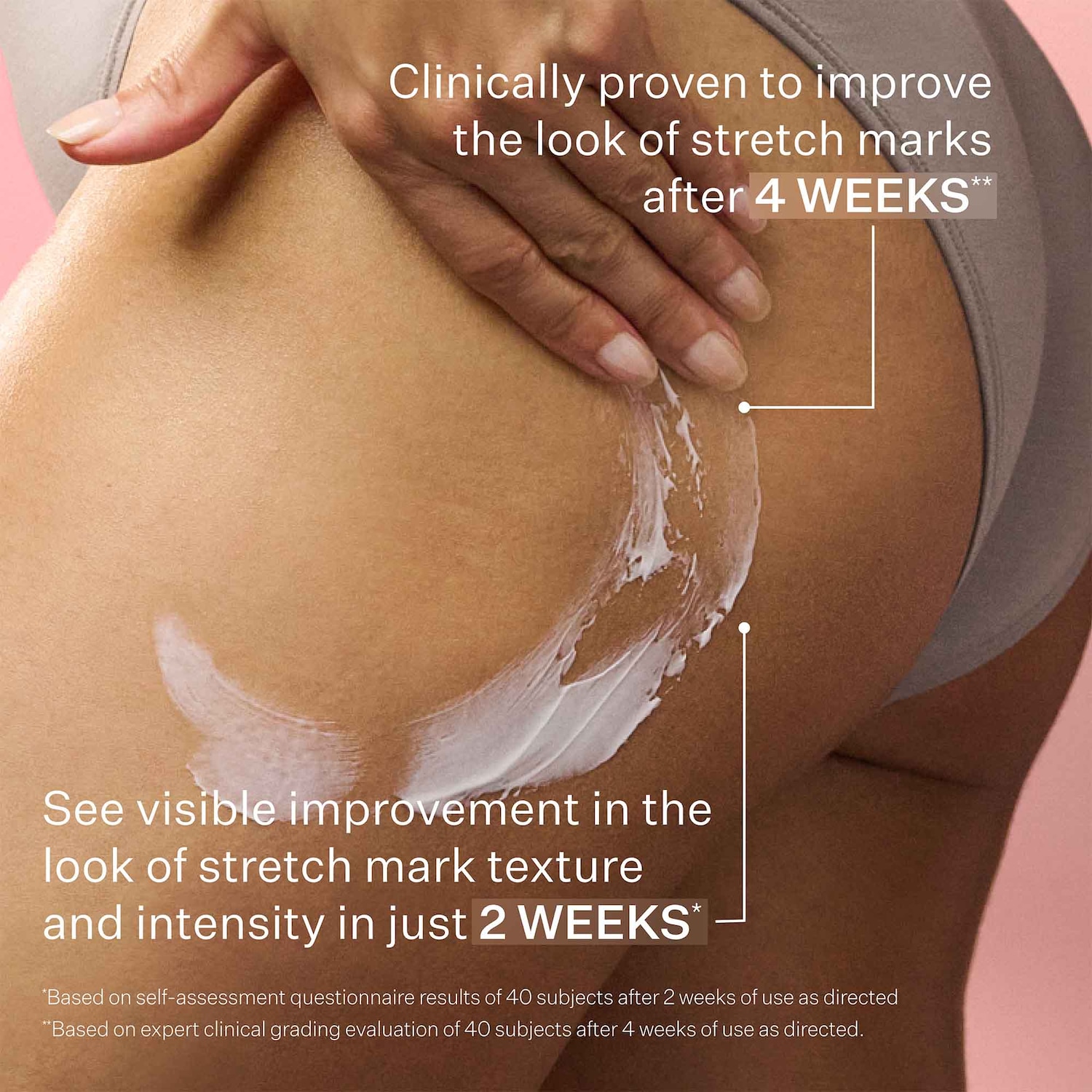 SD Advanced™ PLUS Intensive Moisturizer for Stretchmarks and Wrinkles