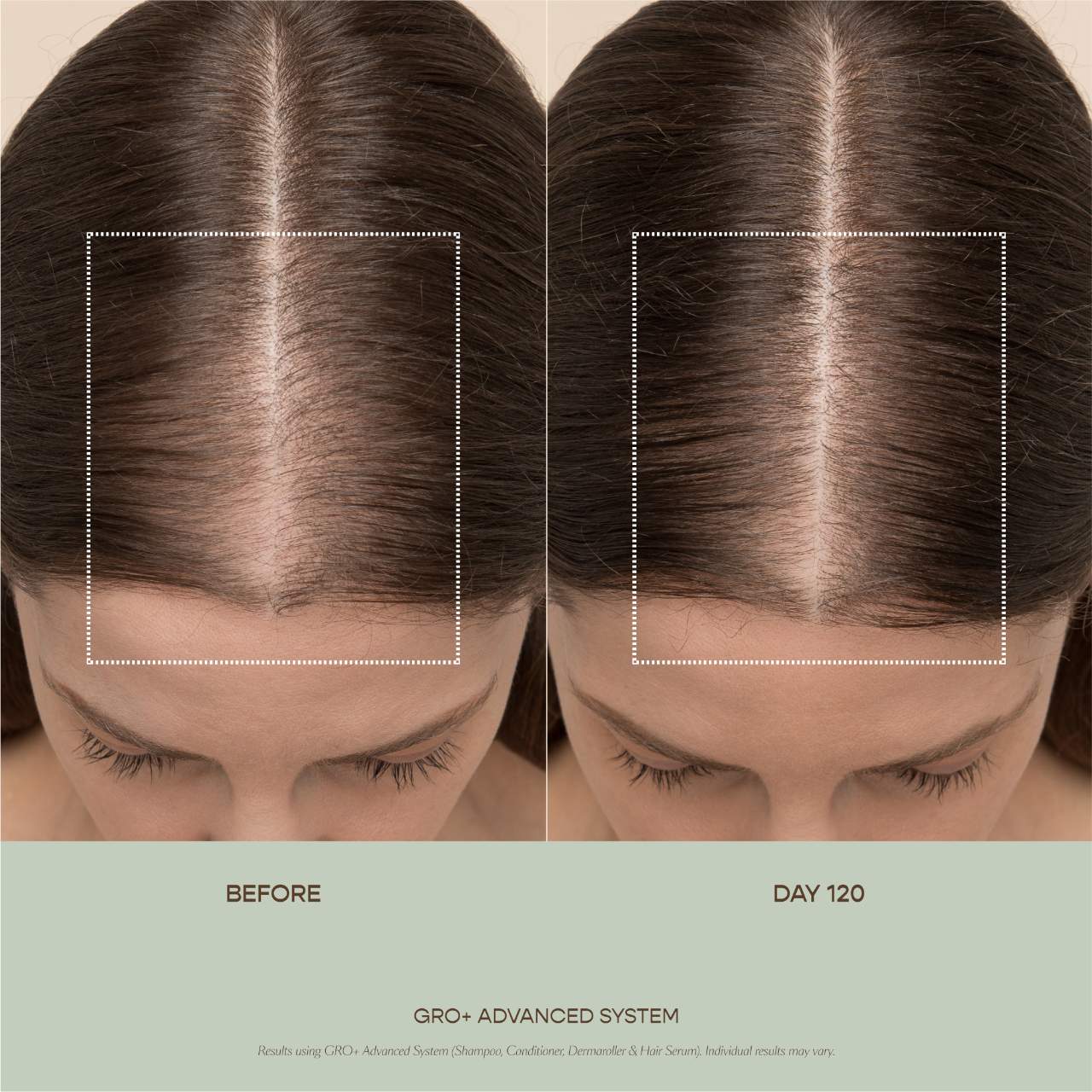 GRO+ Advanced Balancing Shampoo for Severe Signs of Thinning