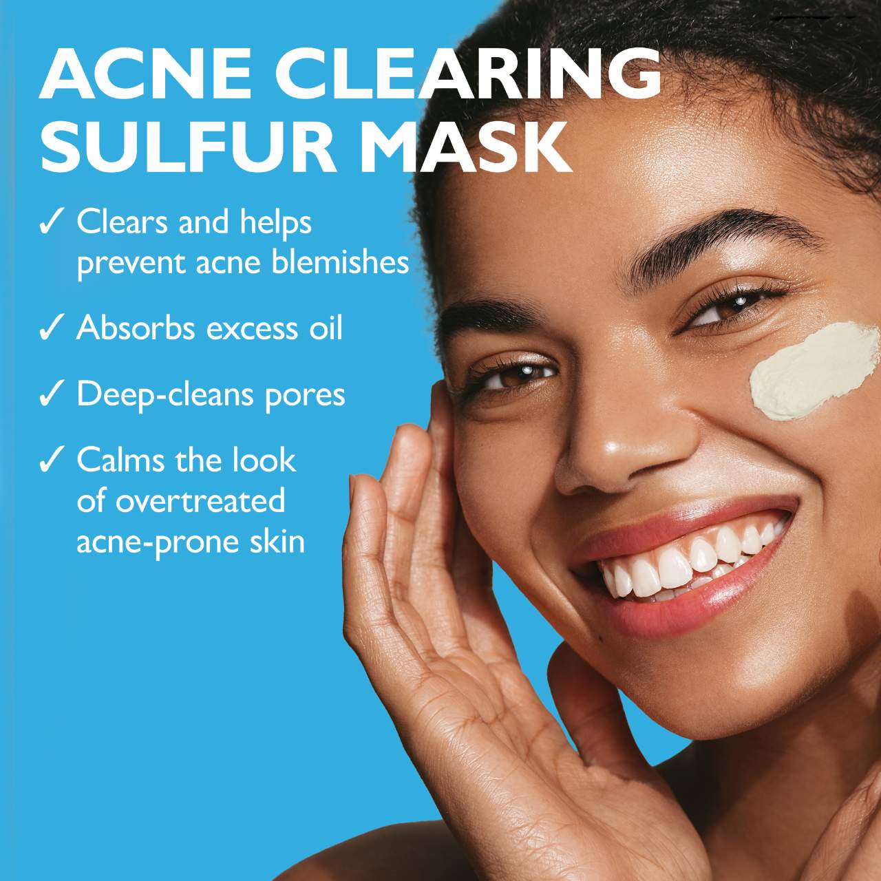 Goodbye Acne™ Therapeutic Sulfur Mask