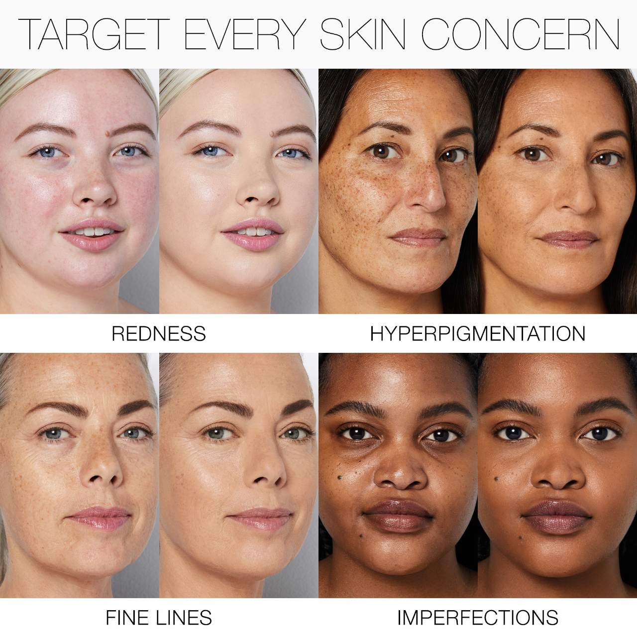 Light Reflecting Advanced Skincare Medium Coverage Foundation